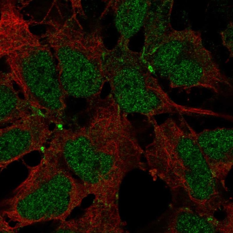 JAM-B/VE-JAM Antibody - BSA Free Immunocytochemistry/ Immunofluorescence: JAM-B/VE-JAM Antibody - BSA Free [NBP2-68604]