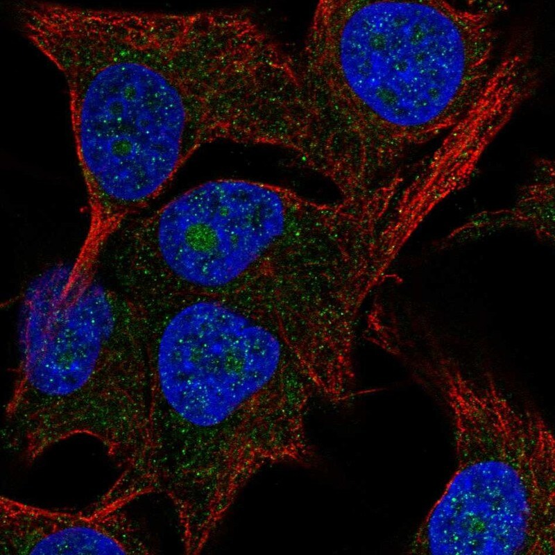 PAK1 interacting protein 1 Antibody - BSA Free Immunocytochemistry/ Immunofluorescence: PAK1 interacting protein 1 Antibody - BSA Free [NBP2-68615]