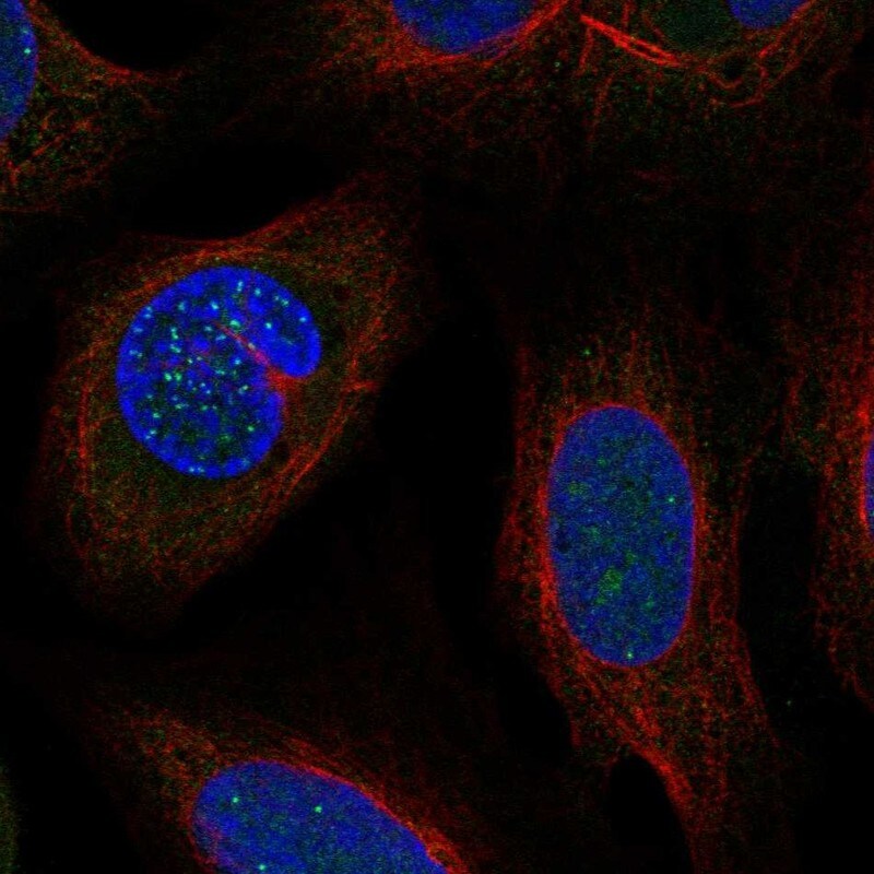 DSN1 Antibody - BSA Free Immunocytochemistry/ Immunofluorescence: DSN1 Antibody - BSA Free [NBP2-68619]