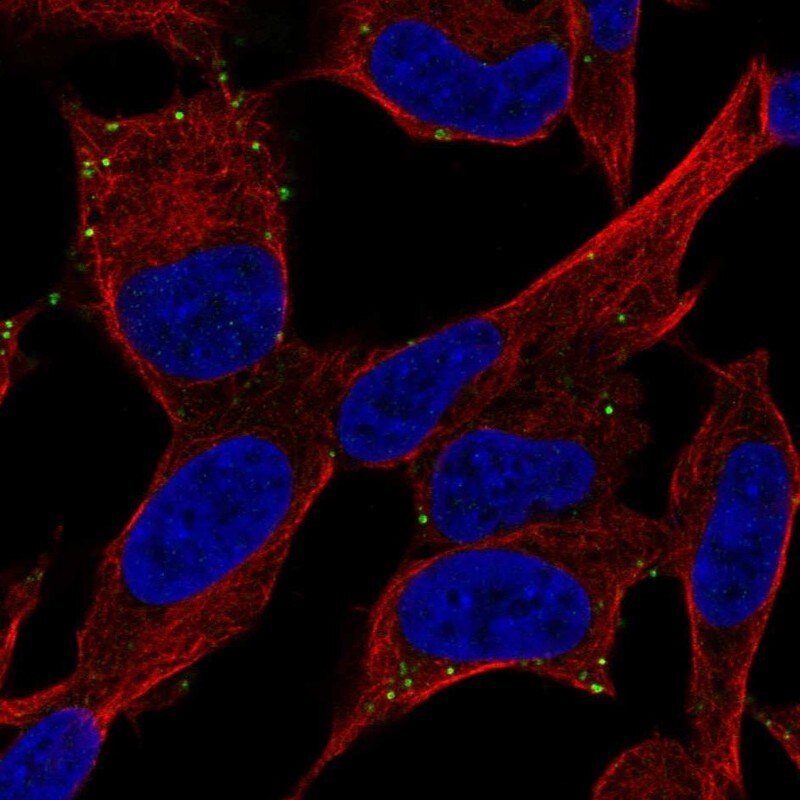 PAC1R Antibody - BSA Free Immunocytochemistry/ Immunofluorescence: PAC1R Antibody - BSA Free [NBP2-68620]