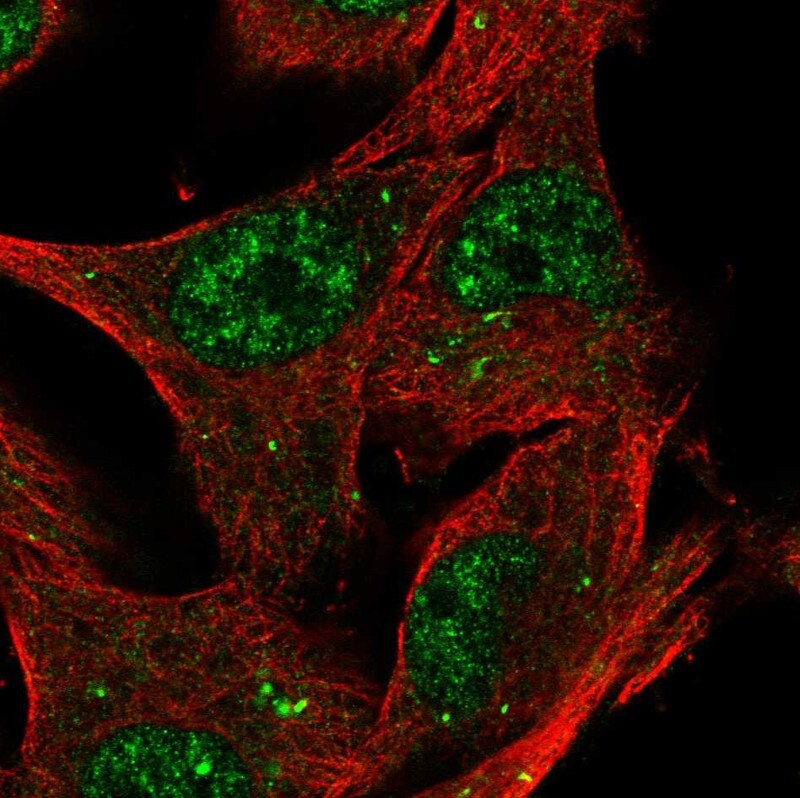 KTI12 Antibody - BSA Free Immunocytochemistry/ Immunofluorescence: KTI12 Antibody - BSA Free [NBP2-68622]