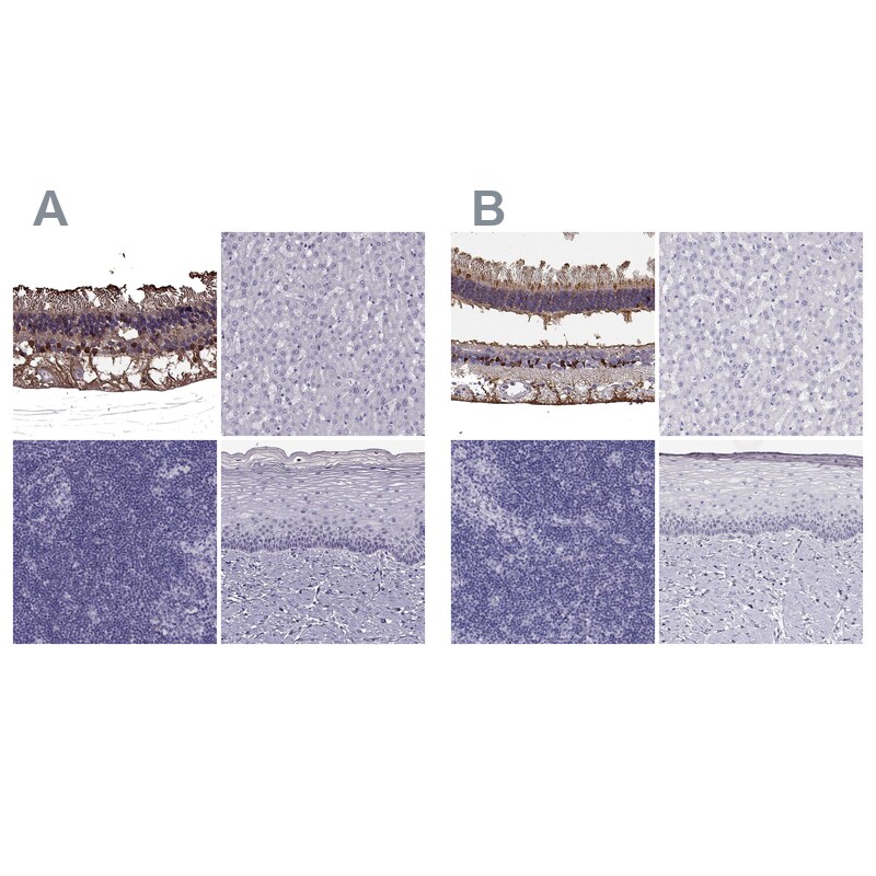 CRALBP Antibody Immunohistochemistry-Paraffin: CRALBP Antibody Antibody [NBP2-68644]
