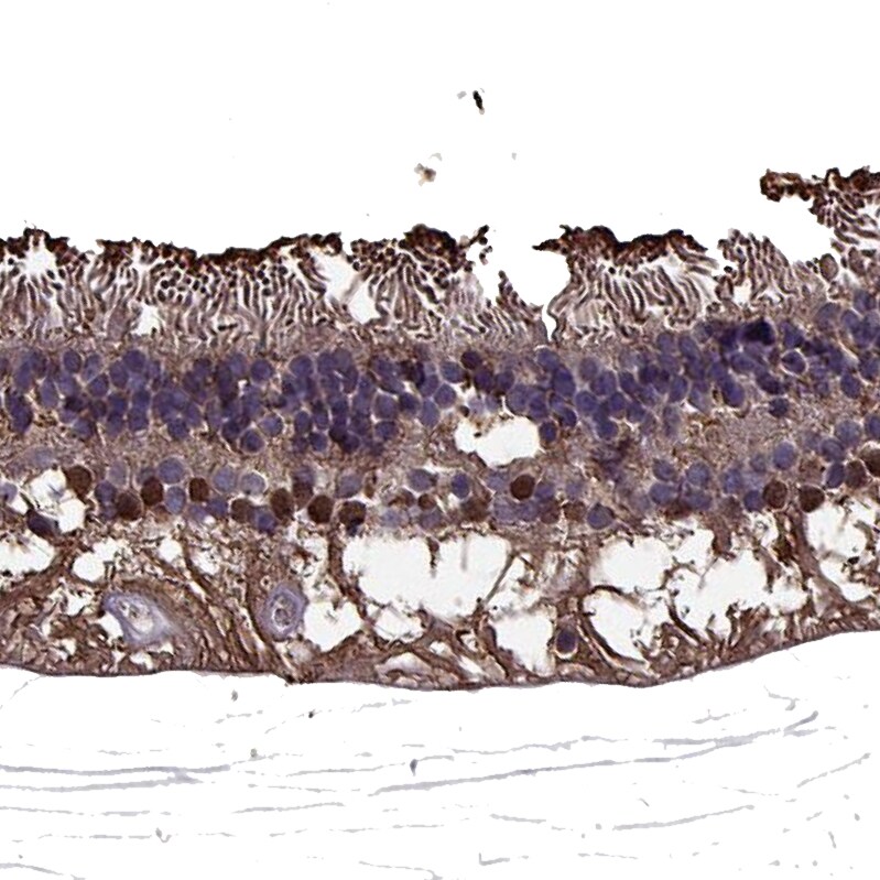 CRALBP Antibody Immunohistochemistry-Paraffin: CRALBP Antibody [NBP2-68644]