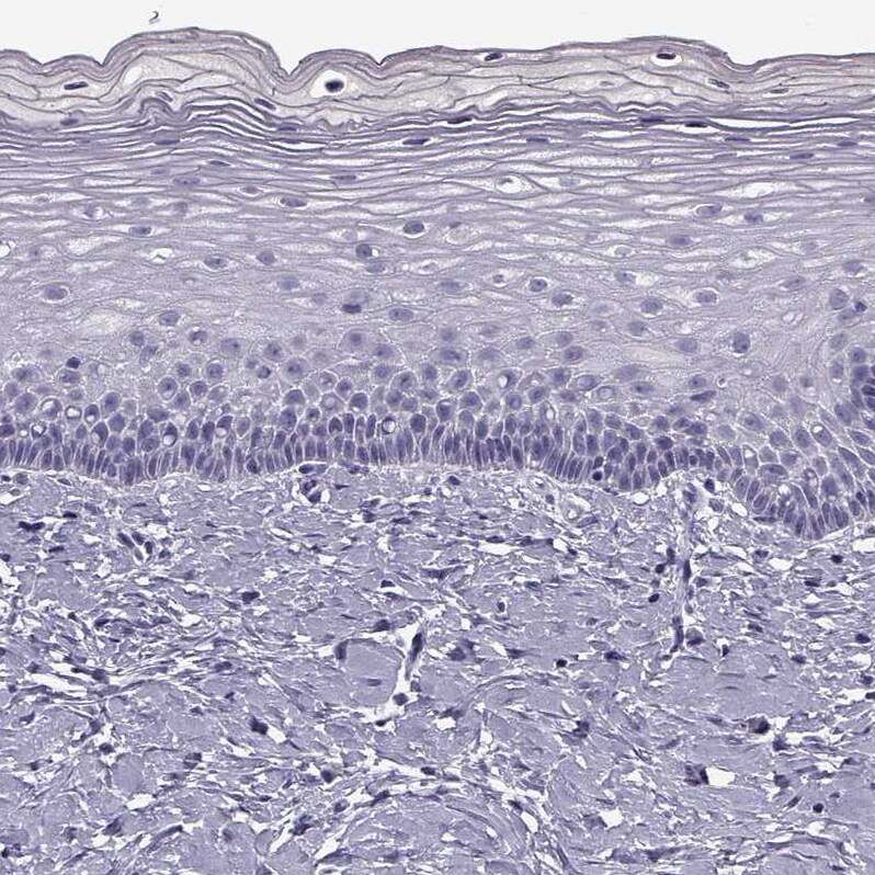 CRALBP Antibody Immunohistochemistry-Paraffin: CRALBP Antibody [NBP2-68644]