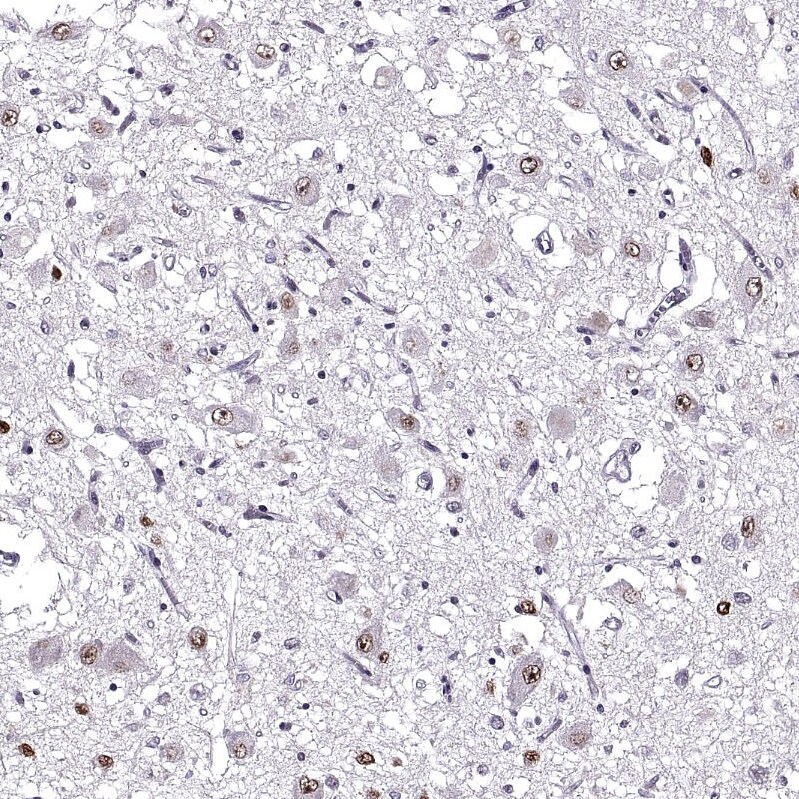 OTP Antibody Immunohistochemistry: OTP Antibody [OTP Antibody]
