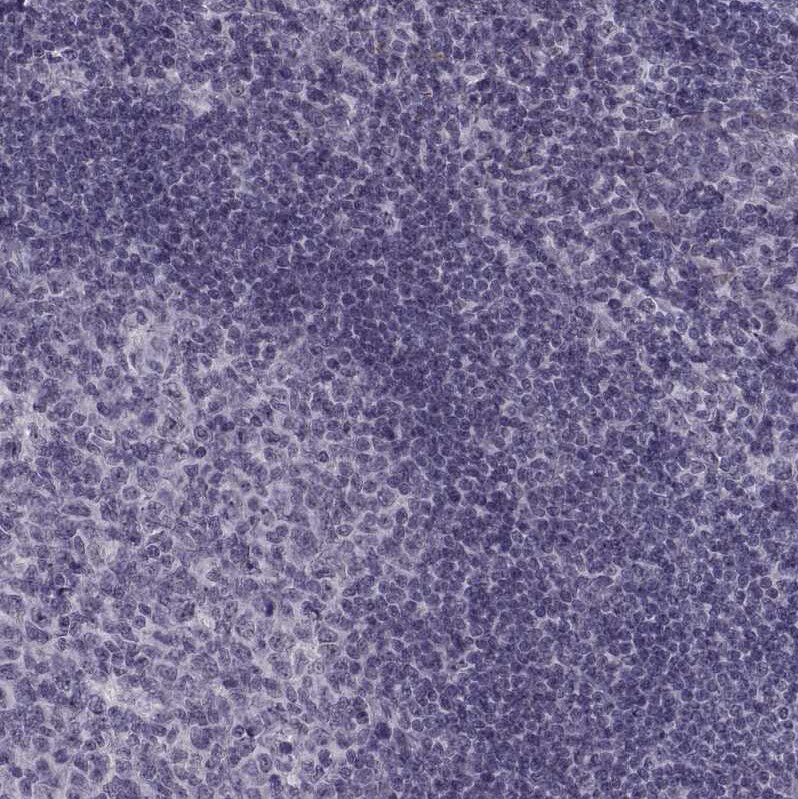 OTP Antibody Immunohistochemistry: OTP Antibody [OTP Antibody]