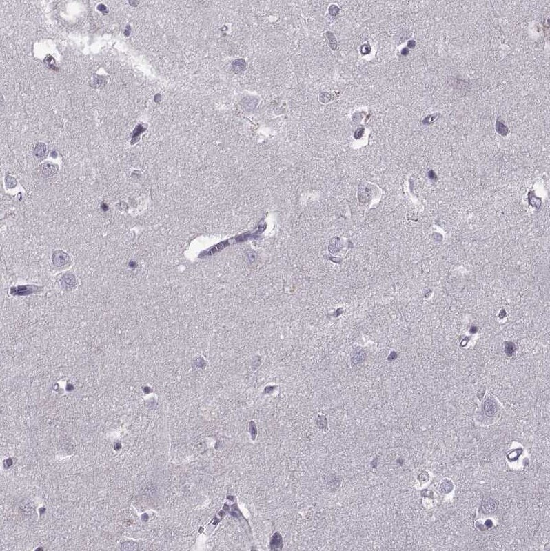 OTP Antibody Immunohistochemistry: OTP Antibody [OTP Antibody]