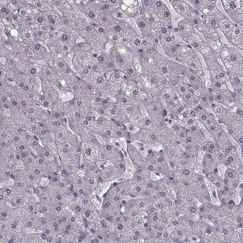 OTP Antibody Immunohistochemistry: OTP Antibody [OTP Antibody]