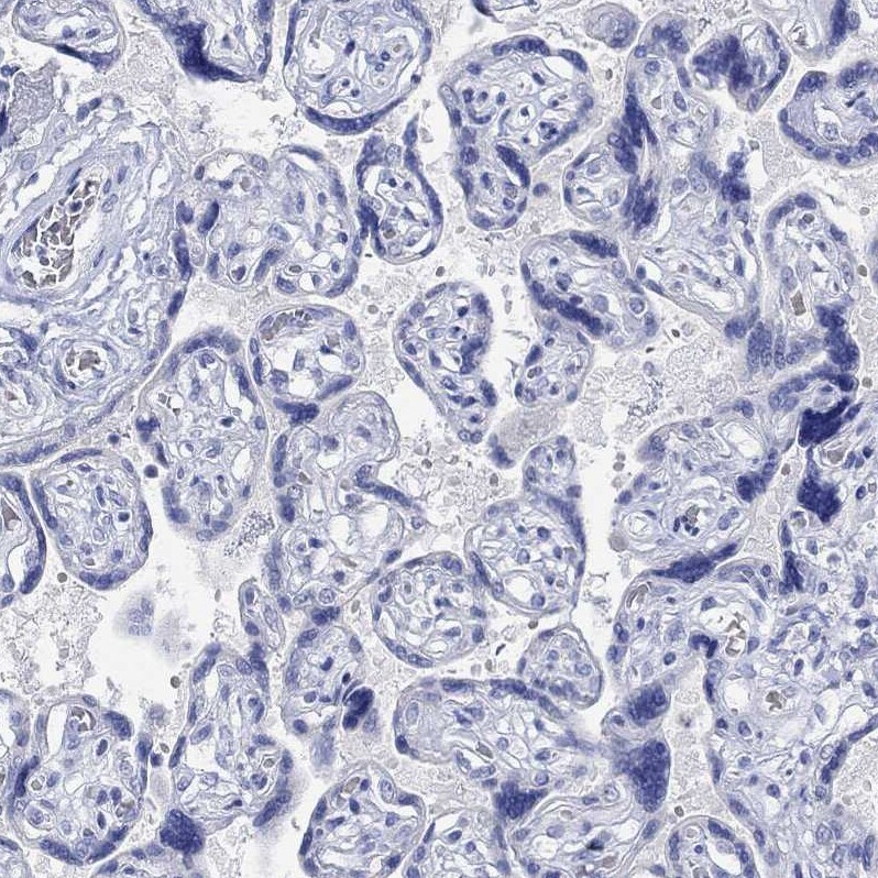 G-substrate Antibody Immunohistochemistry-Paraffin: G-substrate Antibody [NBP2-68949]