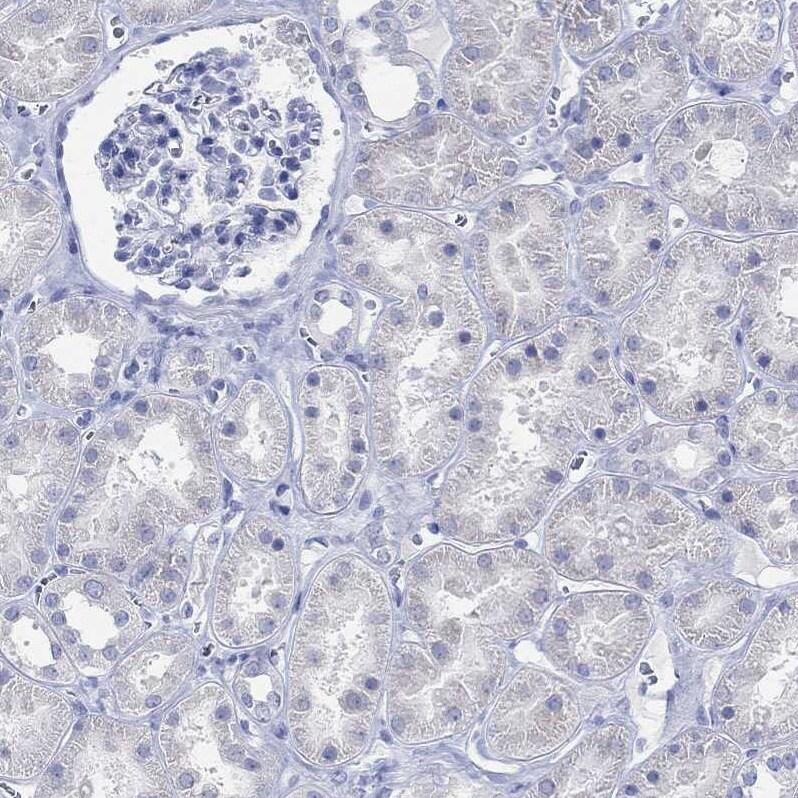 G-substrate Antibody Immunohistochemistry-Paraffin: G-substrate Antibody [NBP2-68949]