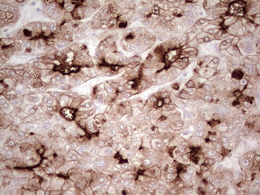MDR1/ABCB1 Antibody (OTI1A7) - Azide and BSA Free