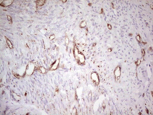 MDR1/ABCB1 Antibody (OTI1A7) - Azide and BSA Free