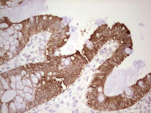 MDR1/ABCB1 Antibody (OTI1A7) - Azide and BSA Free