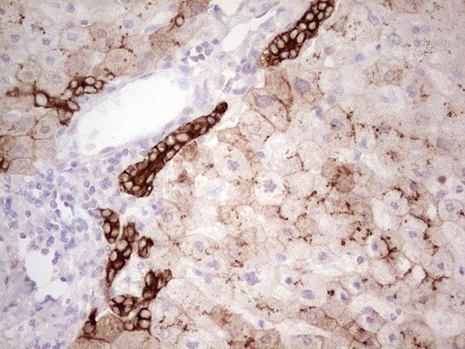 MDR1/ABCB1 Antibody (OTI1A7) - Azide and BSA Free