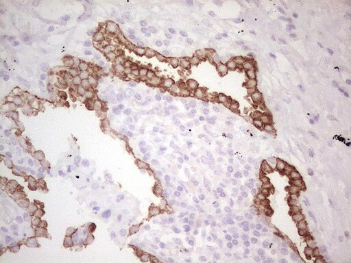 MDR1/ABCB1 Antibody (OTI1A7) - Azide and BSA Free