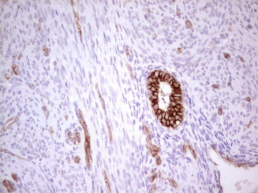 MDR1/ABCB1 Antibody (OTI1A7) - Azide and BSA Free