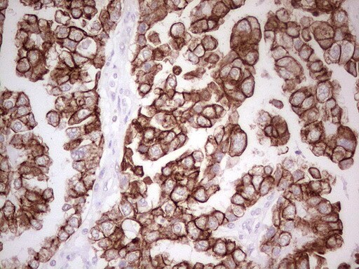 MDR1/ABCB1 Antibody (OTI1A7) - Azide and BSA Free