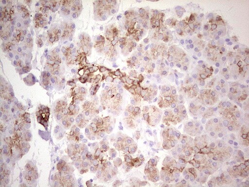 MDR1/ABCB1 Antibody (OTI1A7) - Azide and BSA Free