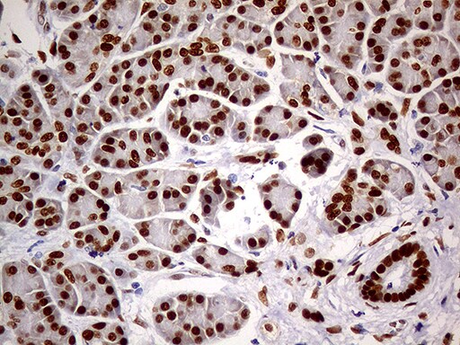 MEIS1 Antibody (OTI2A3)