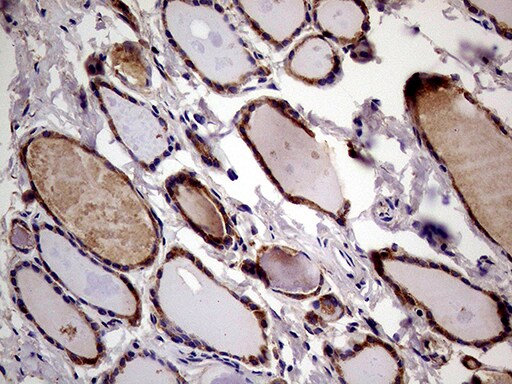 RRBP1 Antibody (OTI3F1)