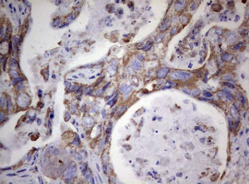 PI 3-Kinase p110 delta Antibody (OTI1D11) - Azide and BSA Free