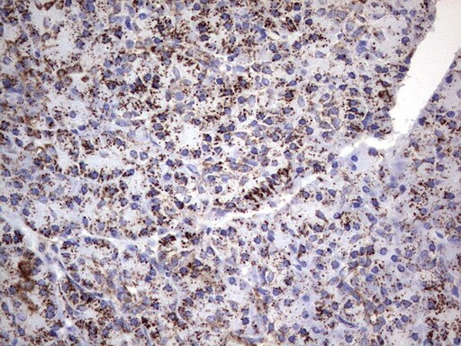 PI 3-Kinase p110 delta Antibody (OTI1D11) - Azide and BSA Free