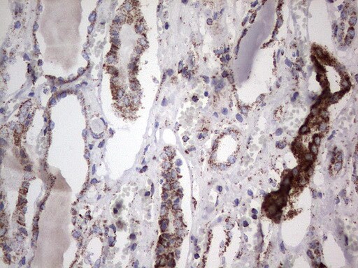PI 3-Kinase p110 delta Antibody (OTI1D11) - Azide and BSA Free