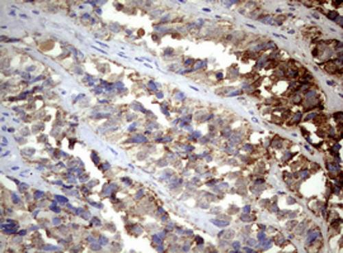 PI 3-Kinase p110 delta Antibody (OTI1D11) - Azide and BSA Free