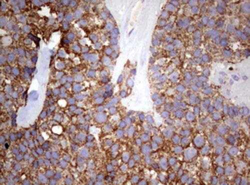 PI 3-Kinase p110 delta Antibody (OTI1D11) - Azide and BSA Free