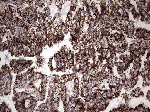 PI 3-Kinase p110 delta Antibody (OTI1D11) - Azide and BSA Free