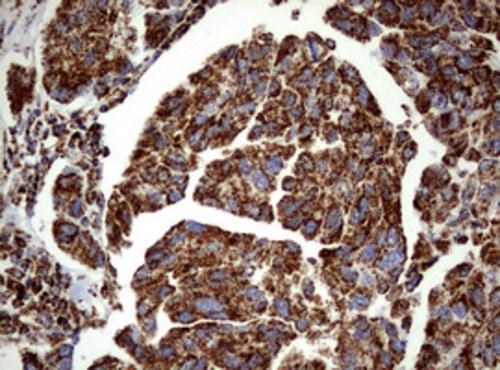 PI 3-Kinase p110 delta Antibody (OTI1D11) - Azide and BSA Free