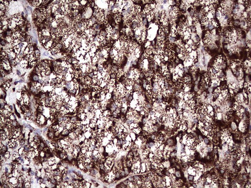 PI 3-Kinase p110 delta Antibody (OTI1D11) - Azide and BSA Free