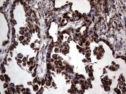 PI 3-Kinase p110 delta Antibody (OTI1D11) - Azide and BSA Free