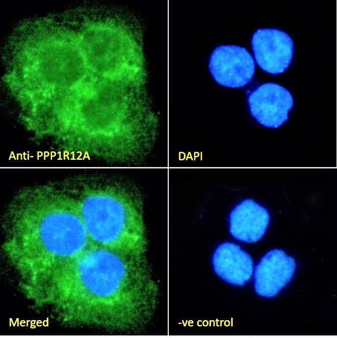 Myosin Phosphatase Antibody