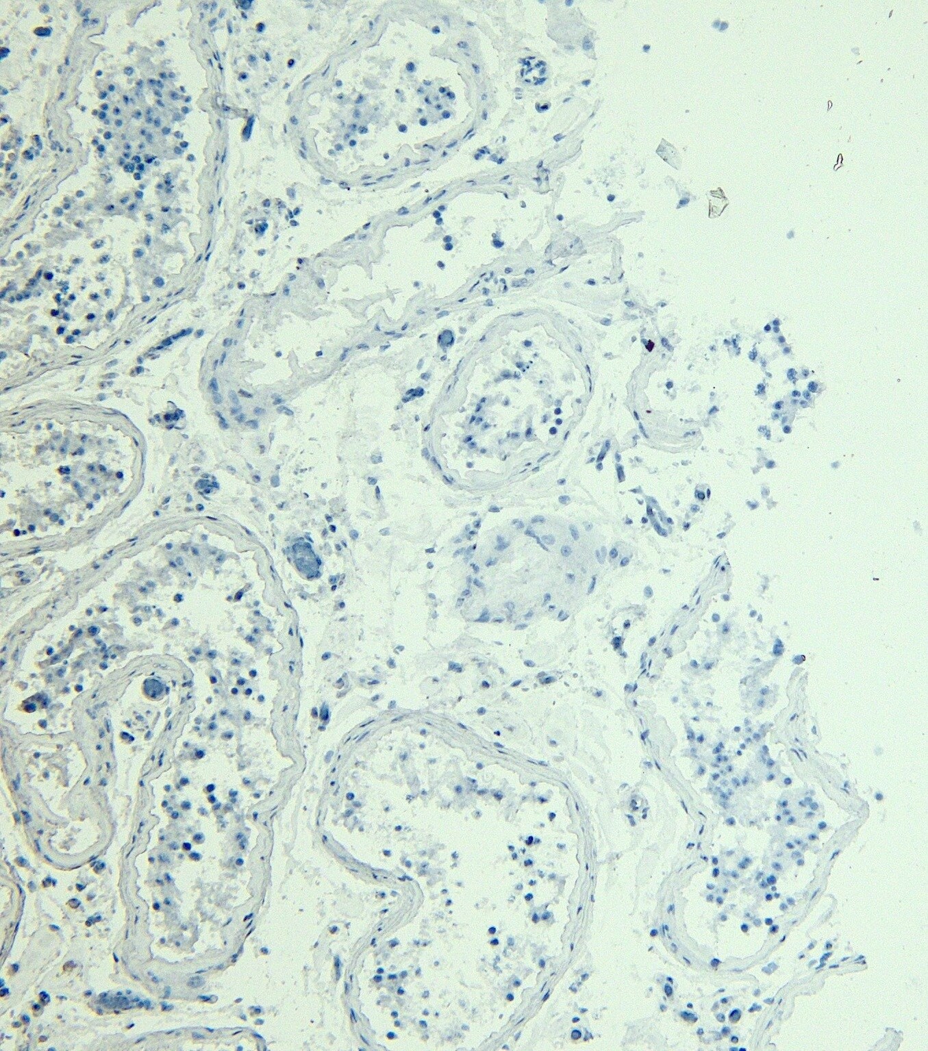 Myosin Phosphatase Antibody