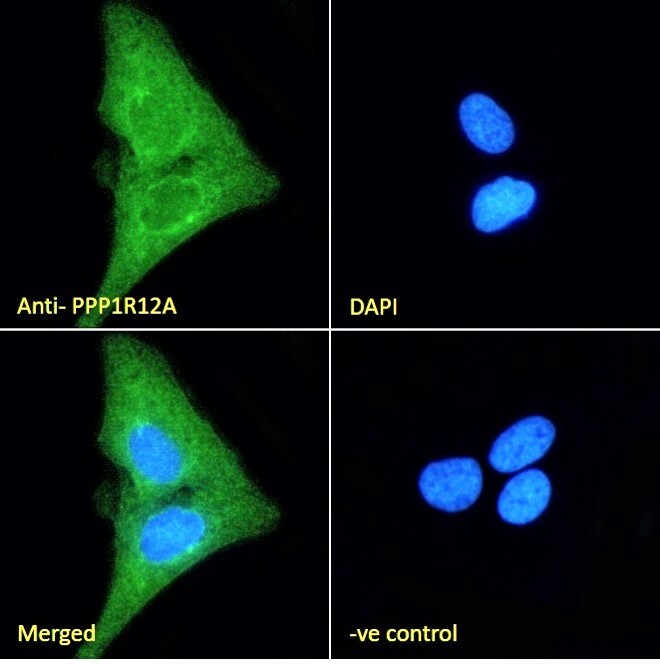 Myosin Phosphatase Antibody