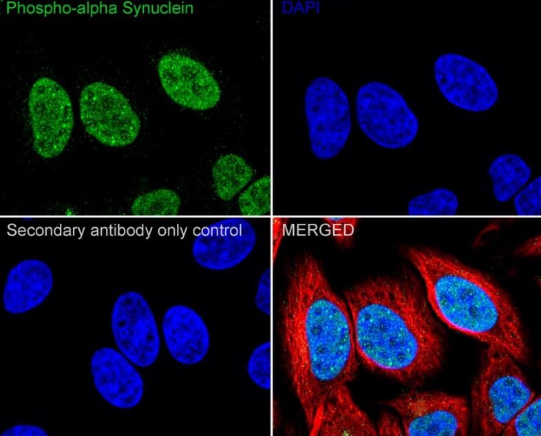alpha-Synuclein Antibody (JB22-44)