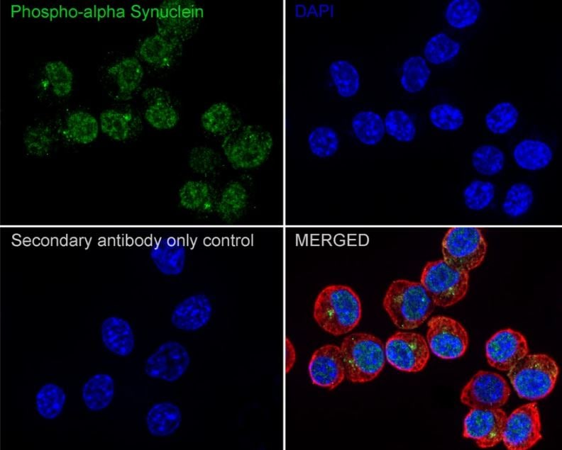 alpha-Synuclein Antibody (JB22-44)