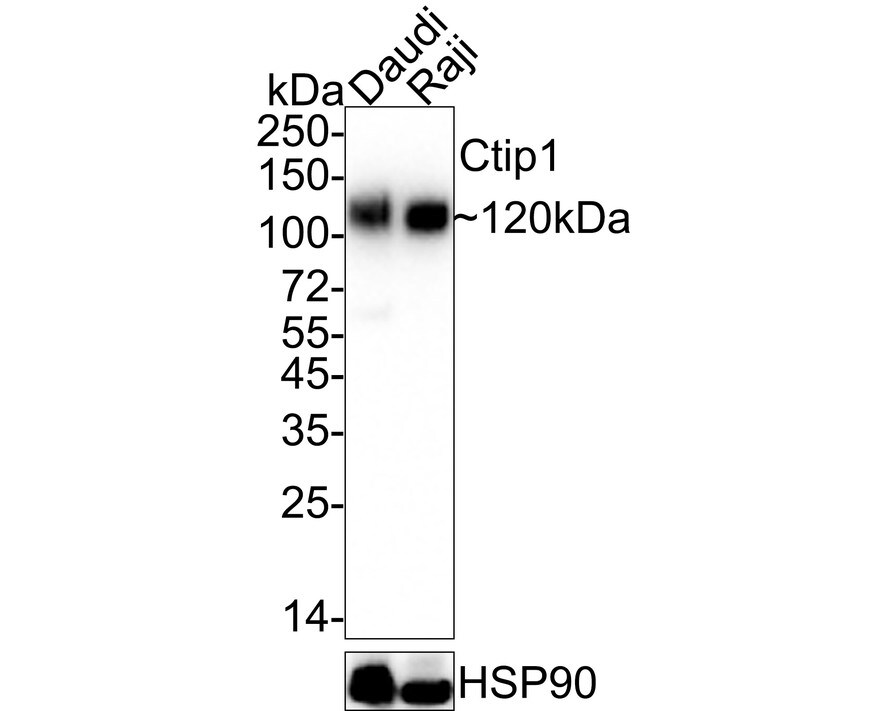 Ctip1 Antibody (JB35-68) Western Blot: Ctip1 Antibody (JB35-68) [NBP2-75455]