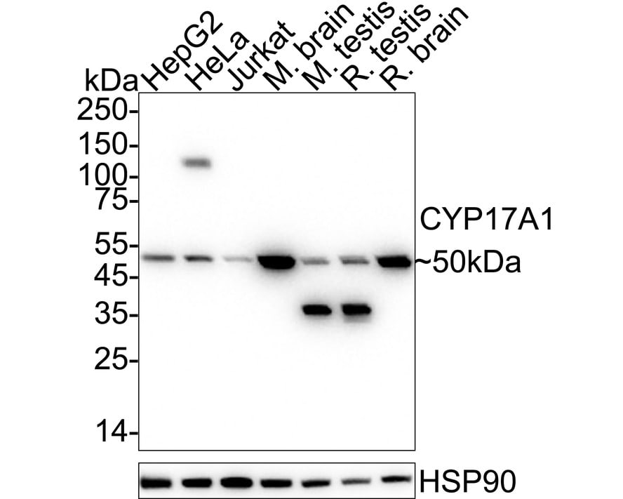 Cytochrome P450 17A1 Antibody (JB93-32) Western Blot: Cytochrome P450 17A1 Antibody (JB93-32) [NBP2-75461]