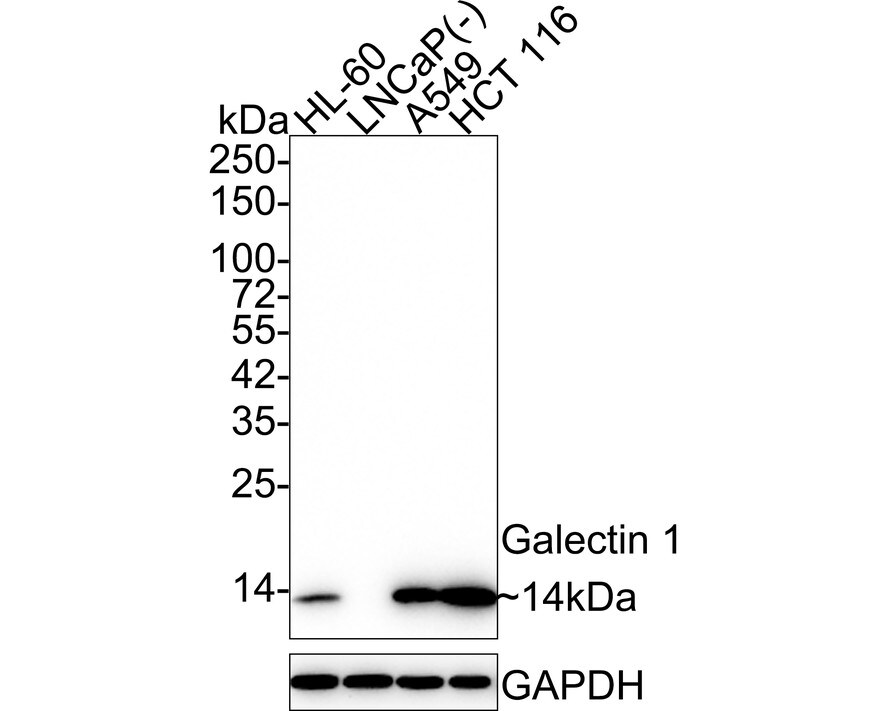Galectin-1 Antibody (JM13-37) Western Blot: Galectin-1 Antibody (JM13-37) [NBP2-75499]