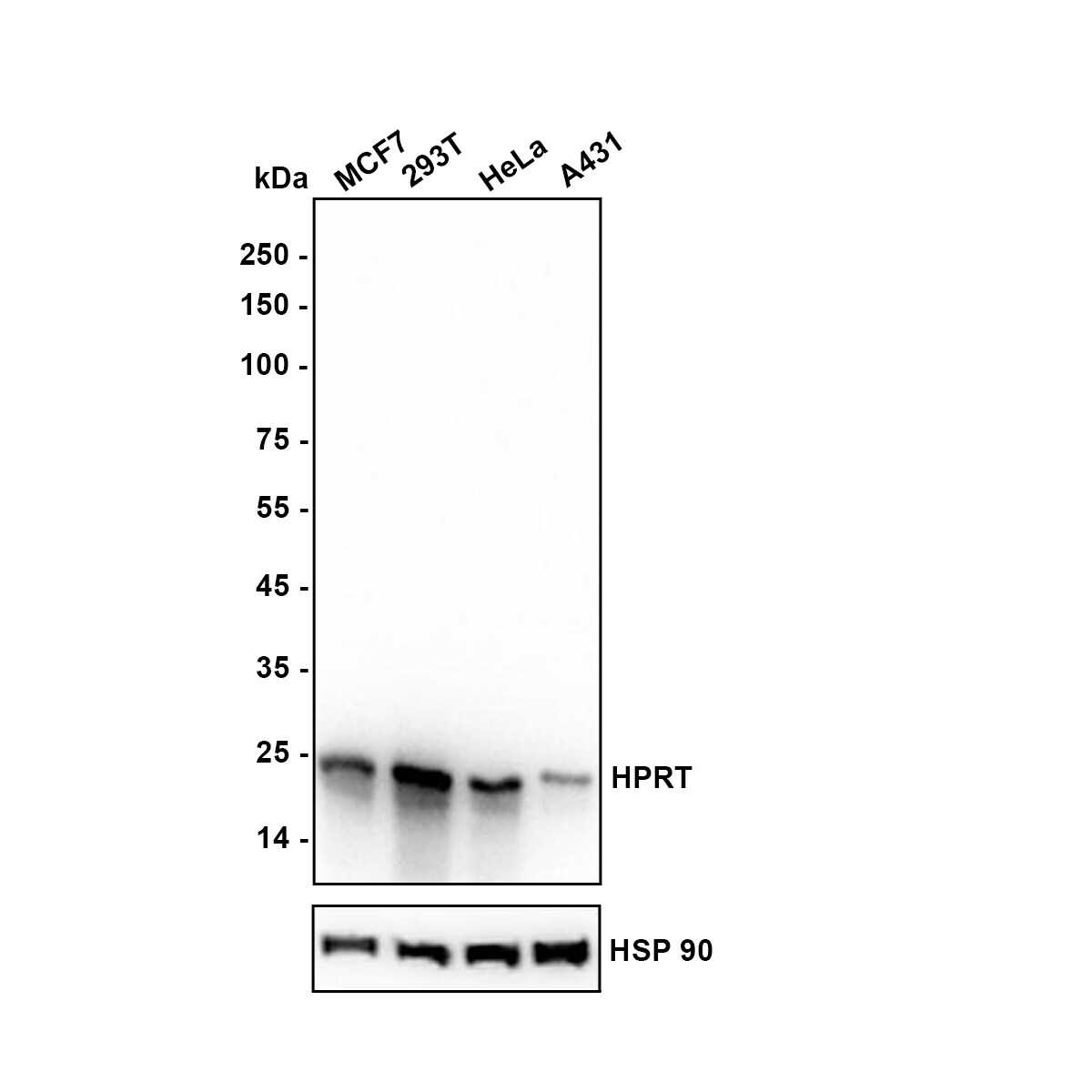 HPRT Antibody (JU03-26) Western Blot: HPRT Antibody (JU03-26) [NBP2-75528]