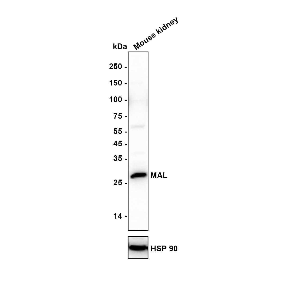 MAL Antibody (B5-G3) Western Blot: MAL Antibody (B5-G3) [NBP2-75563]