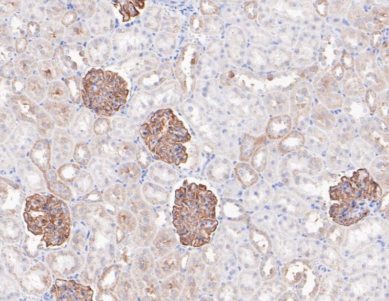 Podocin/NPHS2 Antibody (JB51-33)