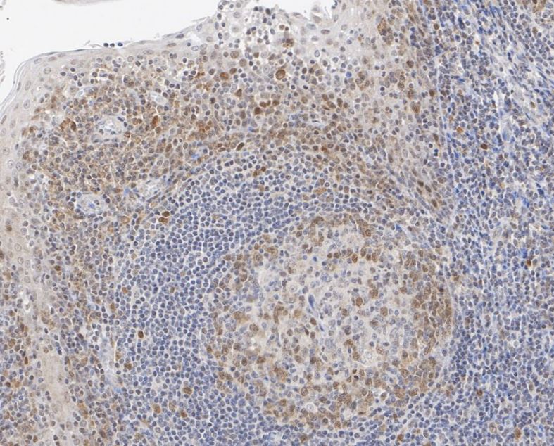 Rad51 Antibody (JM54-26)