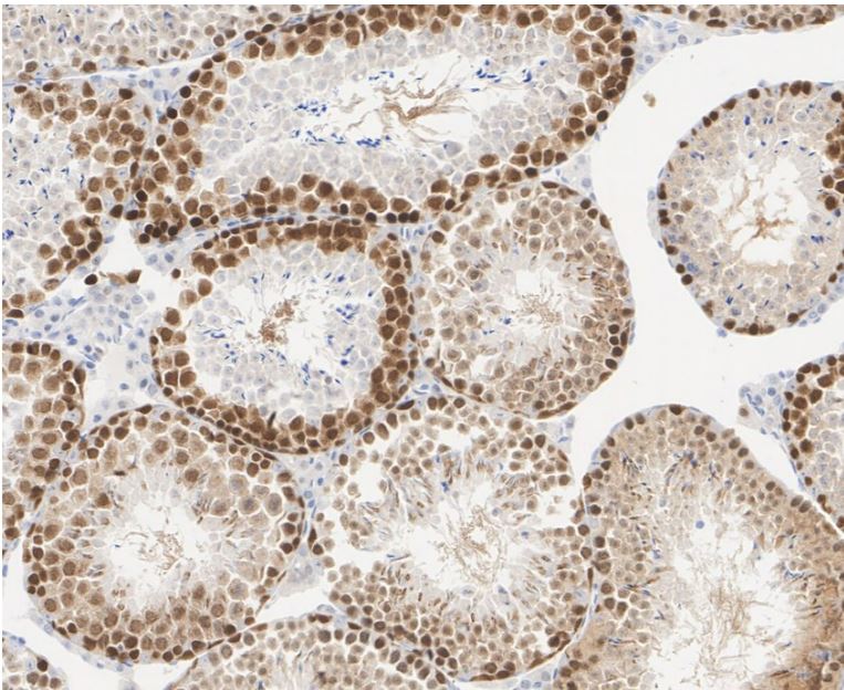 Rad51 Antibody (JM54-26)