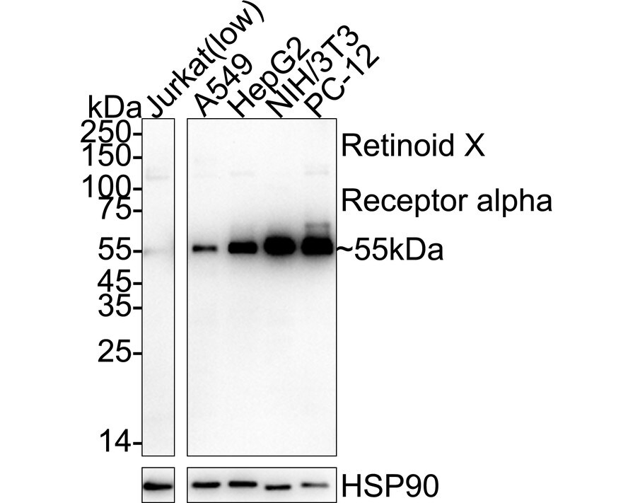 RXR alpha/NR2B1 Antibody (JG99-38) Western Blot: RXR alpha/NR2B1 Antibody (JG99-38) [NBP2-75653]