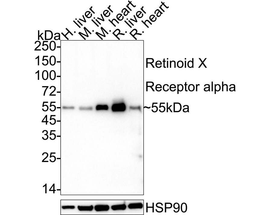RXR alpha/NR2B1 Antibody (JG99-38) Western Blot: RXR alpha/NR2B1 Antibody (JG99-38) [NBP2-75653]