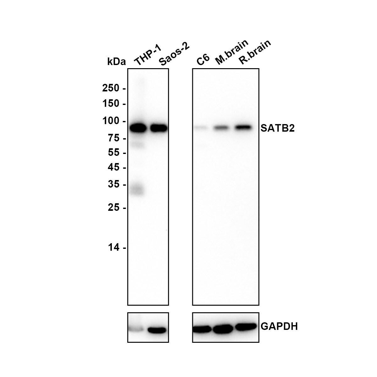 SATB2 Antibody (JM52-44) Western Blot: SATB2 Antibody (JM52-44) [NBP2-75657]