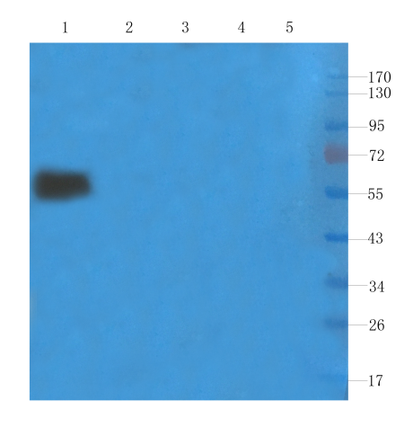 CD25/IL-2R alpha Antibody (Basiliximab) - Chimeric - Azide and BSA Free